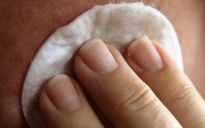 L’eczéma ou dermatite atopique